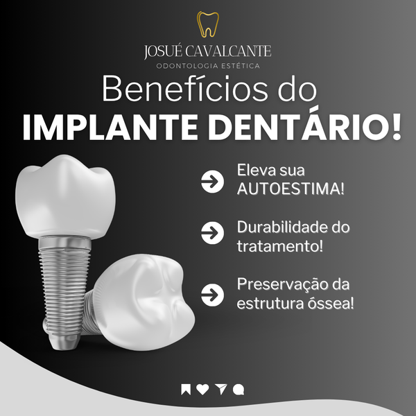 Benefícios do Implante Dentário