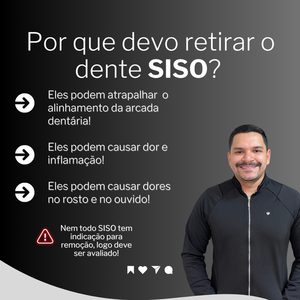 Por que devo retirar o dente SISO?