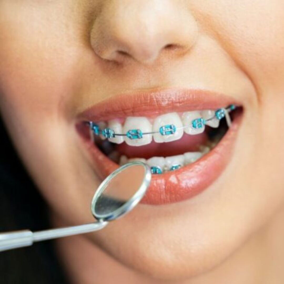 xr:d:DAE-o2w-RNw:806,j:8194693887556111590,t:23062320